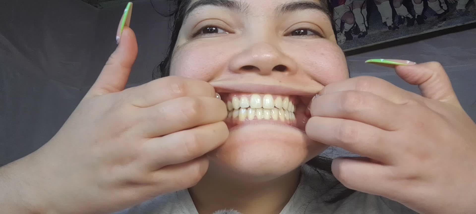 Your Dominant Rotten Girl Shows You Her Yellow, Decayed Teeth