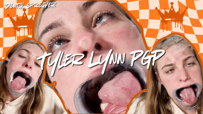 Pgp Dental Spreader- Tyler Lynn