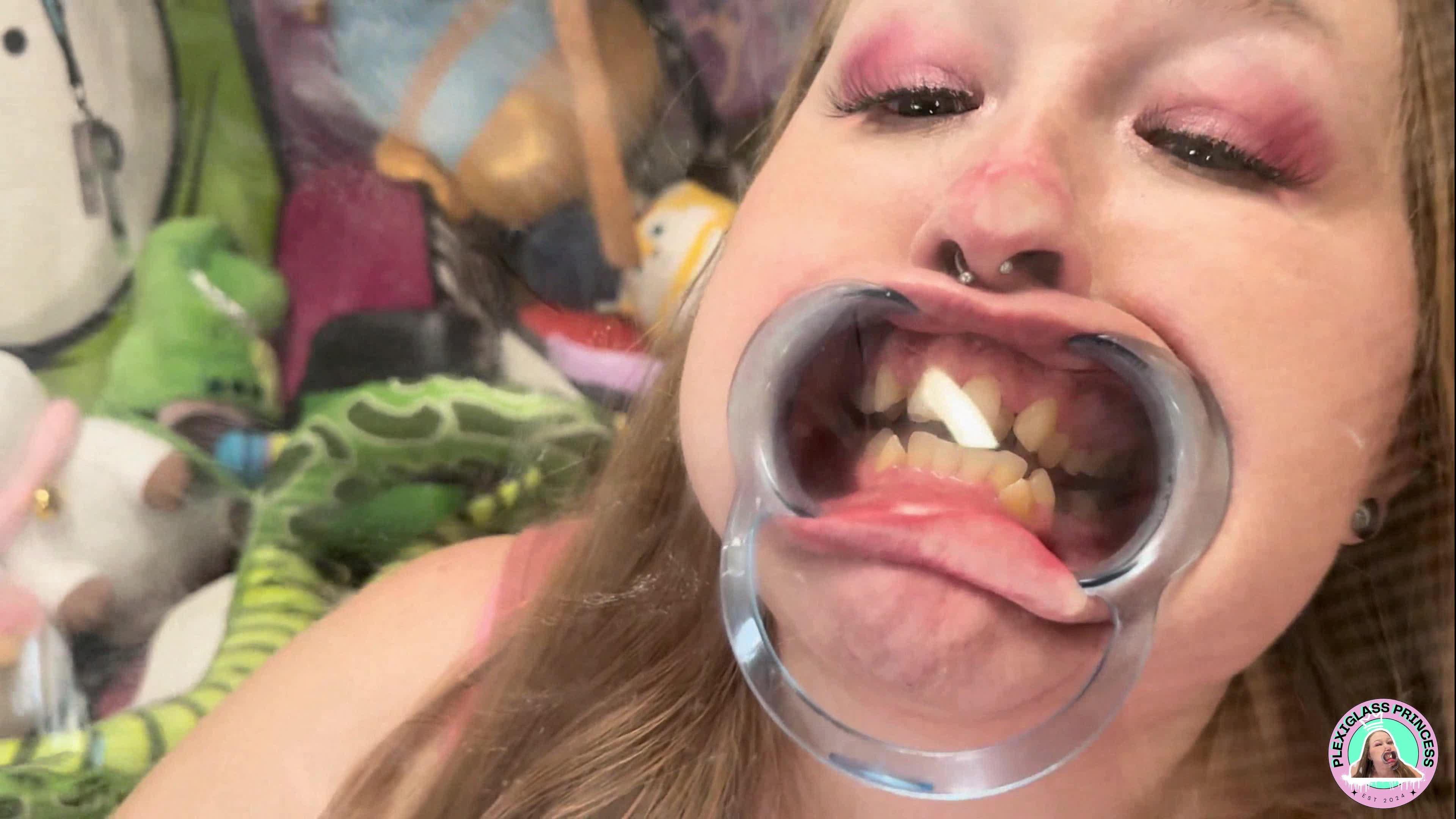 Plexiglass Princess Luna Lee- Dental Apparatus