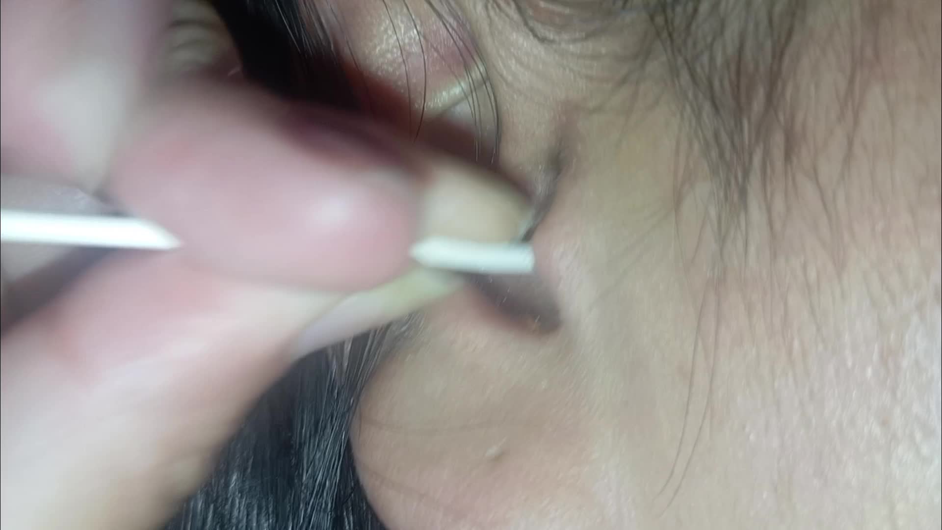 Ear Cleaning