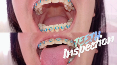 Brushing My Teeth With Braces