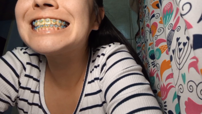 Brushing Yellow Teeth While Wearing Braces