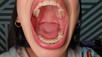 My Open Mouth, Your Fantasy