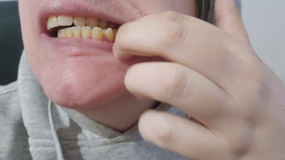 Brushing My Filthy Yellow Teeth Until They Shine