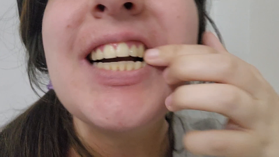 Brushing My Yellow Crooked Teeth