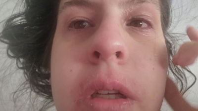 Wet Runny Nose After Crying - Sniffling, Congested, Snot & Real Emotion Fetish