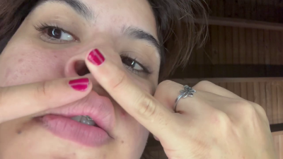 Nose Closeup