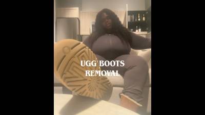 Ugg Boots Removal