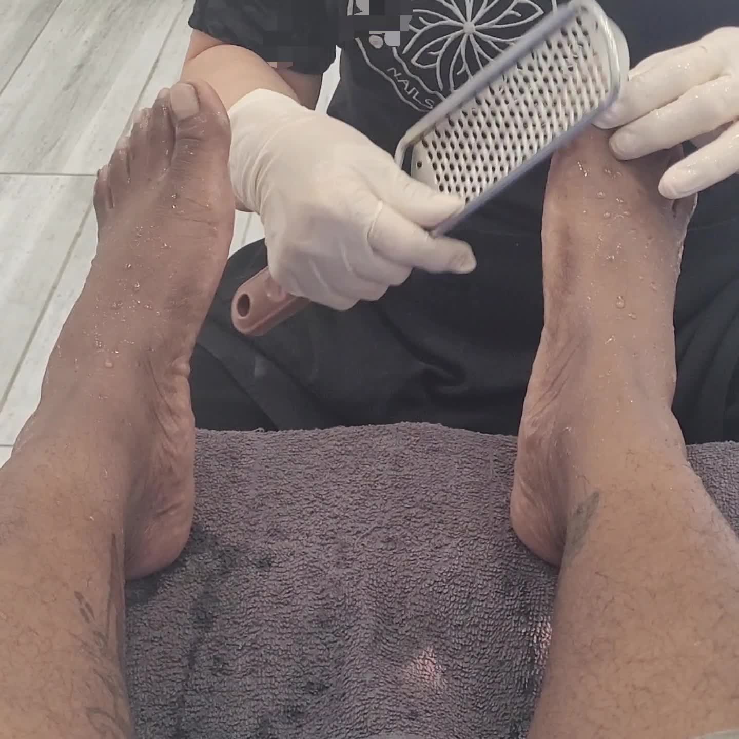 Cleaning Up The Callouses