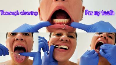 Thorough Cleaning Of My Teeth- Dentist Examination- Mouth Fetish- Tooth Fetish