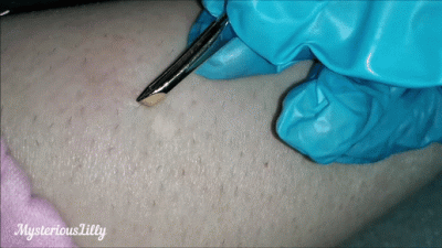 Extreme Close Up On Leg Hair Plucking