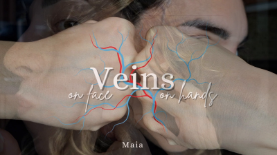 Veins On Face And Hands