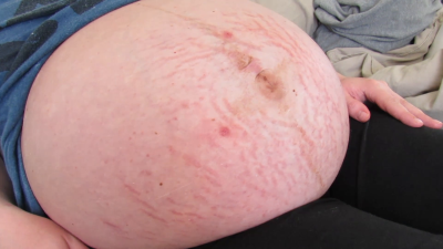 Big Belly Lotion & Movement