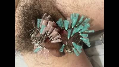More Than 50 Needles In Penis And Balls