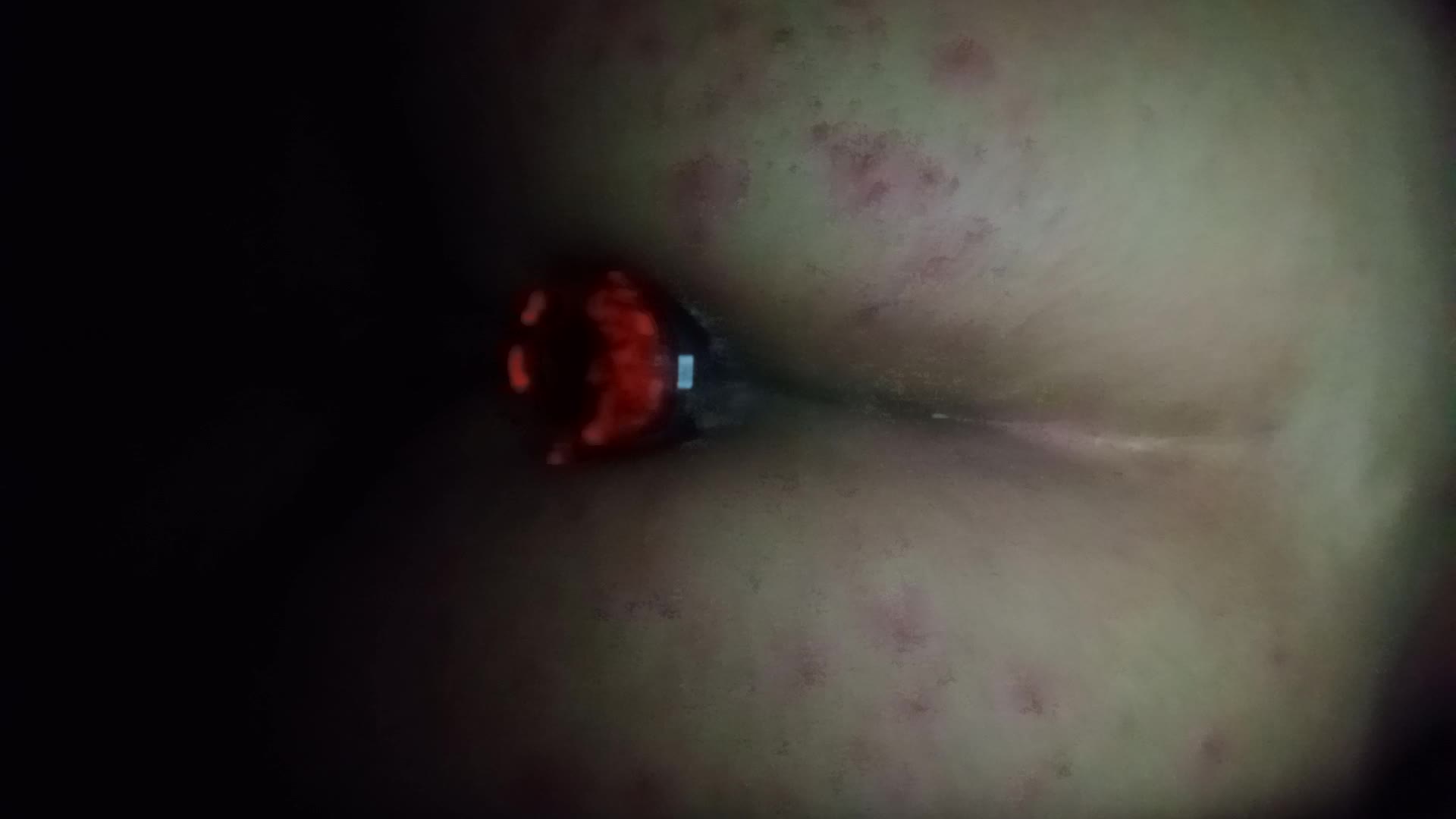 Hidden Muscle- Neon Blue Anal Plug Play (Deep Push Out & Suck Back)