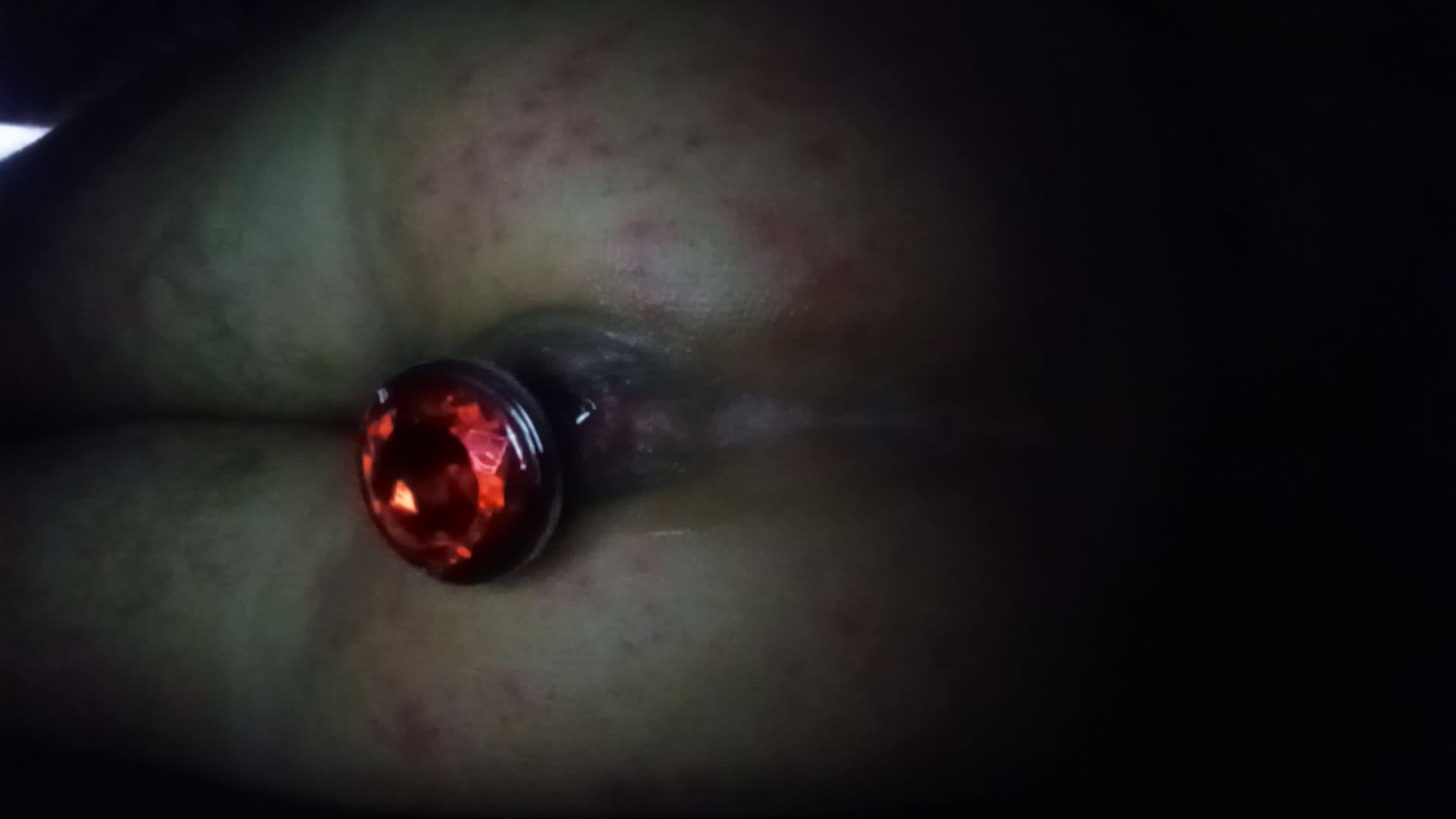 Hidden Muscle- Deep Anal Stretching (Side View & Close-Up)