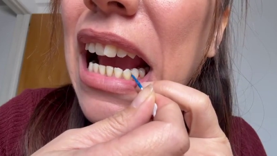 Detailed Teeth Cleaning