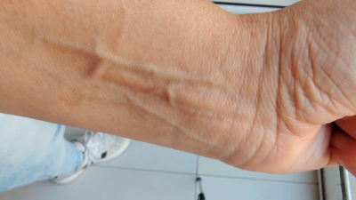 Visible Veins Appreciation