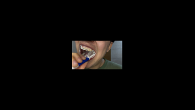 Dental Play: Lots Of Foam And Close-Up Brushing