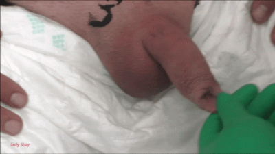 Vorhaut Zugenaht! Keuschheit Fur Die Sissy Clit!