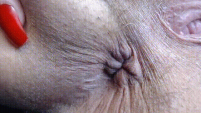 Asshole Extreme Closeup Hairy