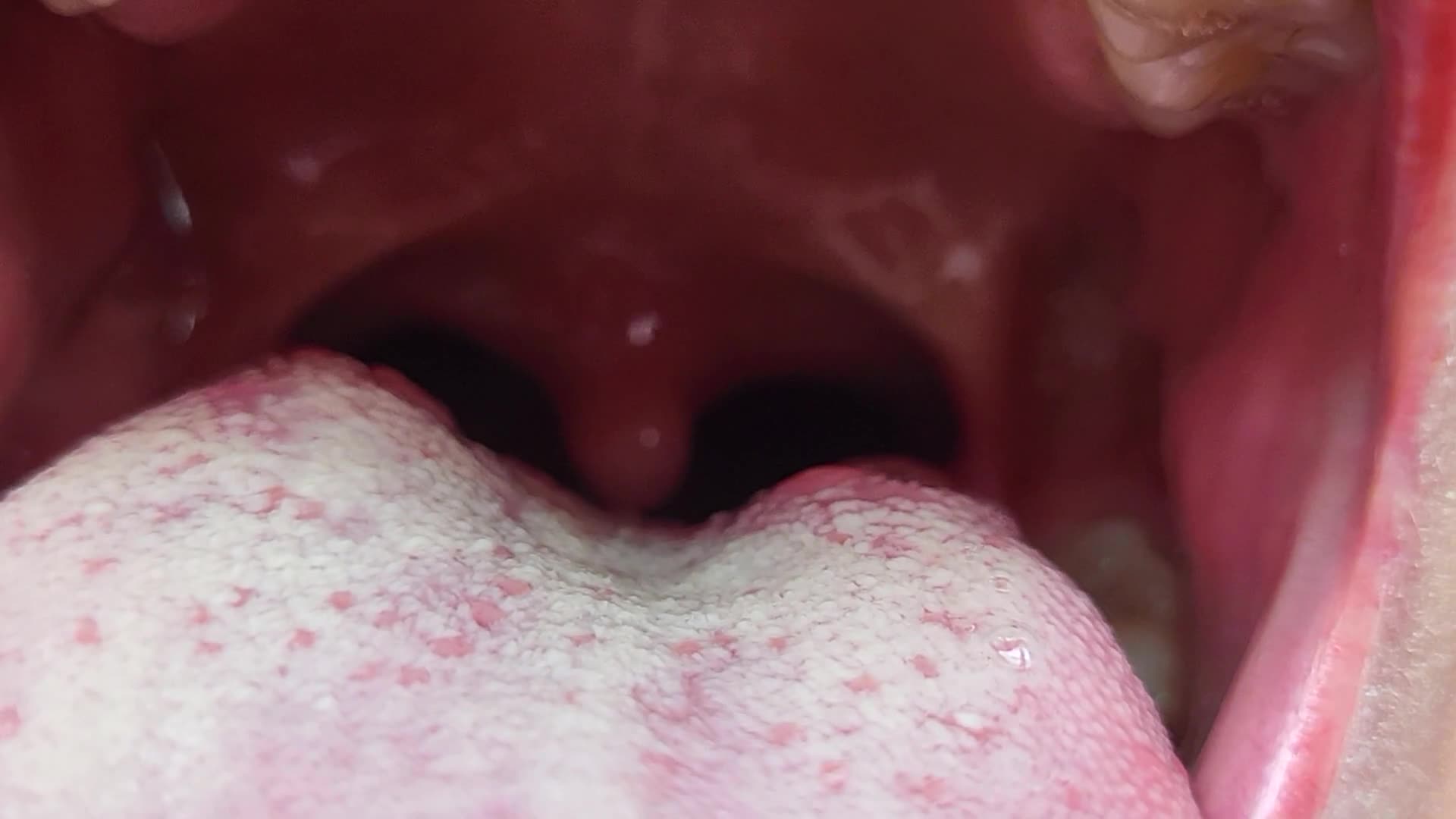 Mouth, Tongue, Uvula Tour