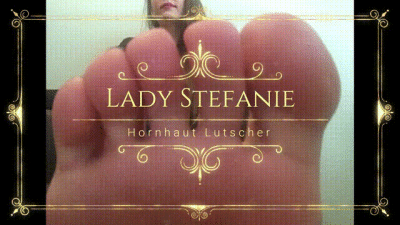 Hornhaut Lutscher German