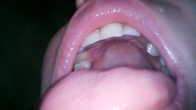 Endoscope: In My Mouth (S)