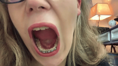 Licking & Tasting My Teeth And Braces( Mouth Showoff)