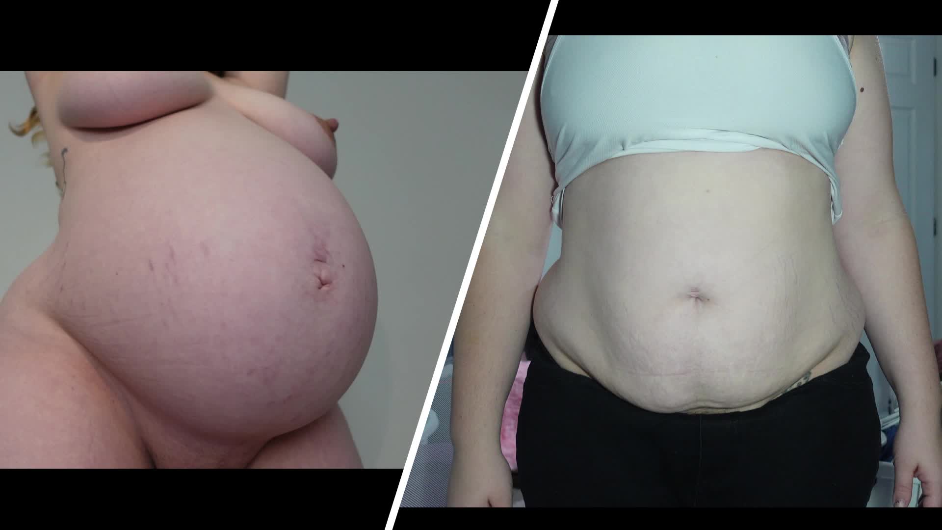 Comparing My Pregnant And Postpartum Belly