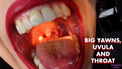 Big Yawns, Uvula And Throat (Video Request)
