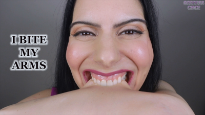 I Bite My Arms (Video Request)