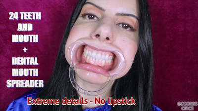 24 Teeth And Mouth + Dental Mouth Spreader Extreme Details, No Lipstick