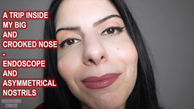 A Trip Inside My Big And Crooked Nose Endoscope And Asymmetrical Nostrils (Video Request)