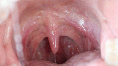 My Sexy Wet Uvula HD