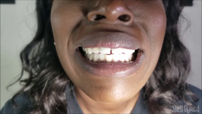 Sore Lymph Nodes And Uvula Tour