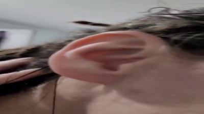 Ear Rubbing And Pulling