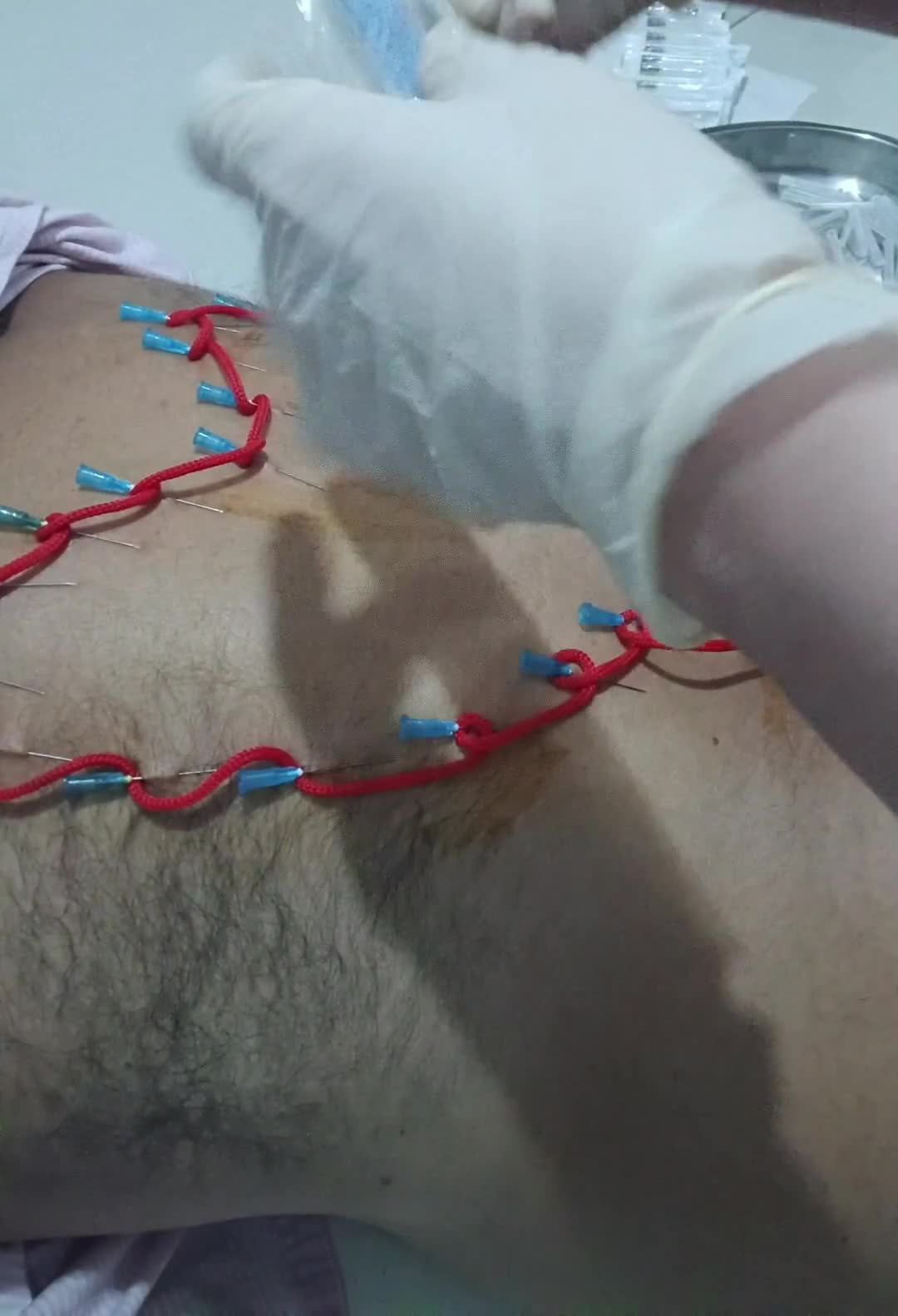 Art Draft By Needles (Clip In Arabic)