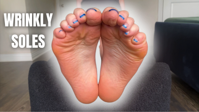 Wrinkly Soles