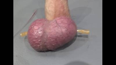 Destroying The Balls With Needles