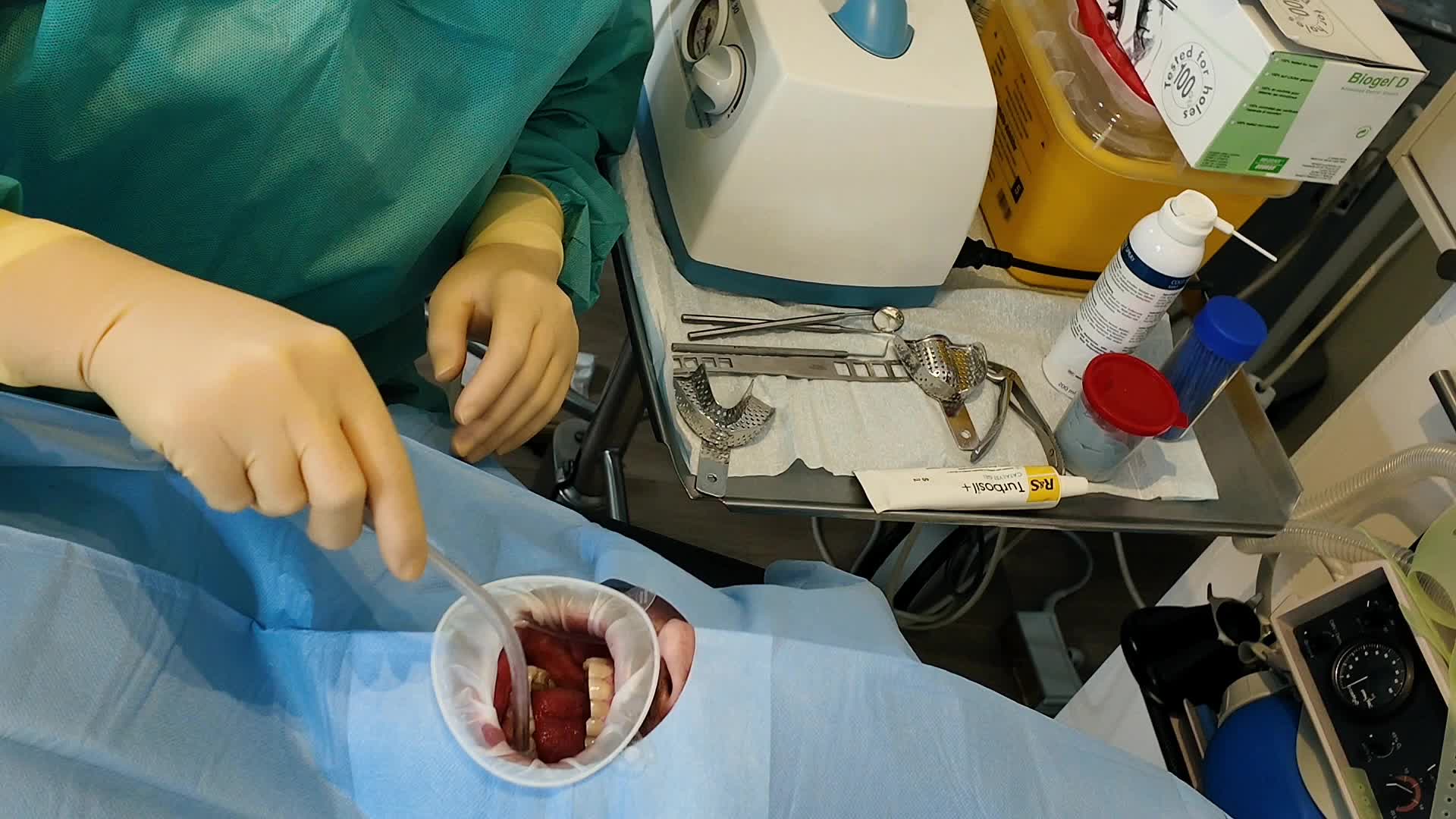 Dental Examination And Extraction With Biogel Dental D Gloves And A Surgical Gown