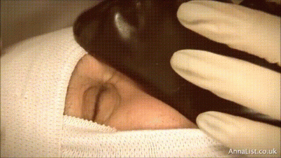 At The Dentist In The 1970S Part 2