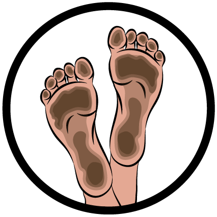 Dirty Feet