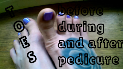 Lady Angela Hand Held Toes Before During Andfter A Pedicure