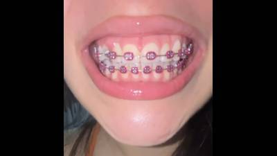 My Mouth And Your Mouthfetish